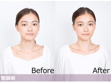 ～全身の［キレイ］を促す【ヒト幹細胞ヘッドスパ】とは？？ before～afterで解説＊