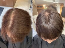 エルプラスヘアー 平尾店(L+hair)の雰囲気（トップや前髪の分け目を目立ちづらく！【髪質改善/縮毛矯正】 ）