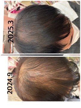 モエちょき ヒト幹細胞110%