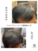 スカルプクレンジング