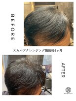 ヘアディボーション(HairDevotion)&nbsp;スカルプクレンジング