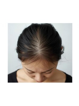 《最先端のエイジングケア＆育毛促進》美容成分を豊富に含んだケアで頭皮やお肌の環境を整えます♪