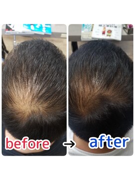 ルーミールーム(RoomieRoom) 頭皮改善！育毛促進ケア！