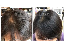 ヘアーサロン リュクス(hair salon Luxe)の雰囲気（気になるトップのボリューム【頭皮ケア専門店★Luxe★うるま】）