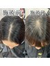 【前髪の割れ癖改善】前髪Xパーマ+顔周りカット+ケアシステム　【縮毛矯正】