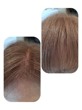 ユーフォルムギンザ(y-Forme Ginza) 話題のトキカタ♪前髪編