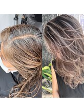  施術後に特別なケアは必要ですか？