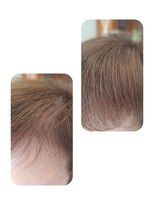 ユーフォルムギンザ(y-Forme Ginza) 話題のトキカタ♪前髪編