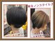 ビューティースポットカルサーの写真