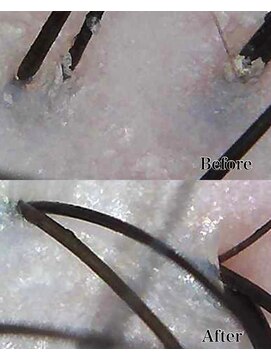 グロウズ(GROW’S) 地肌改善ヘッドスパ