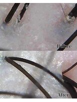 グロウズ(GROW’S) 地肌改善ヘッドスパ