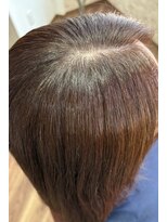 グロース(growth)&nbsp;Before→after