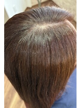 グロース(growth) Before→after