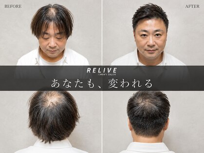 RELIVE名古屋 -メンズサロン- 個室マンツーマンの写真