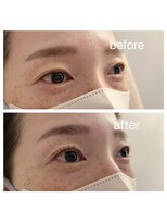 クロト(Clotho)&nbsp;パリジェンヌラッシュリフト