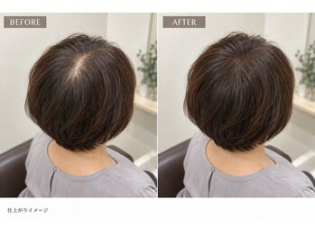 増毛エクステサロン スマイリー(smily)の写真/【増毛エクステ専門店】前髪/つむじ/トップ/ボリュームが気になる方におすすめ☆長年の悩みを解決します!