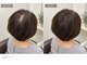 増毛エクステサロン スマイリー(smily)の写真/【増毛エクステ専門店】前髪/つむじ/トップ/ボリュームが気になる方におすすめ☆長年の悩みを解決します!