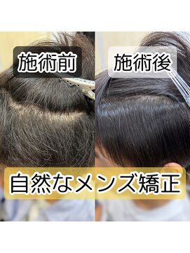 エフスタイル(F-style) メンズ矯正