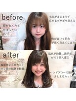 アマトウキョウ 表参道(AMA TOKYO)&nbsp;顔わまり