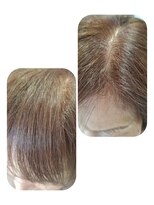 ユーフォルムギンザ(y-Forme Ginza)&nbsp;話題のトキカタ♪前髪編