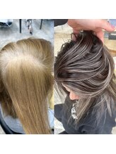 肌が弱いのですが。大丈夫でしょうか？**