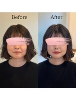 レトア(Letoa)&nbsp;ビフォーアフター