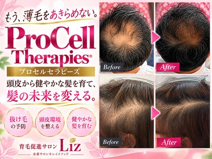 リズ(Liz)の写真