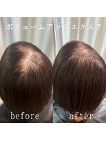 ツムグ 代官山店(TUMUGU)&nbsp;おとな女性悩み解消ボリュームアップエクステつむじ割れ/代官山