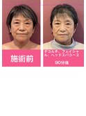 しらゆきコース