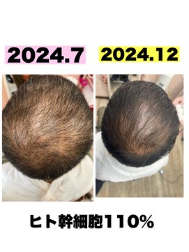 モエちょき ヒト幹細胞110％