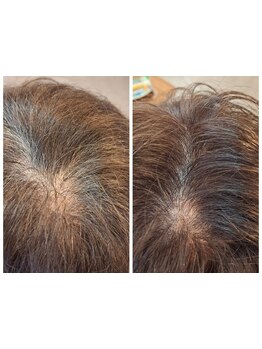 髪と頭皮に優しいダメージレスカラーで透明感抜群！自然で艶感のある白髪染めを使わない白髪ぼかし◇