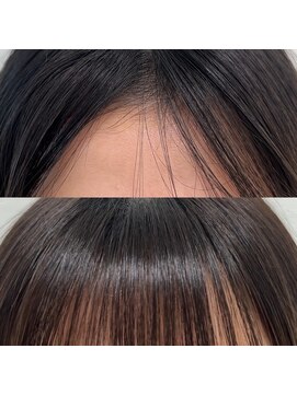 ミユーズ 表参道(Miyu's) 割れ癖解消矯正