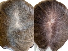 ヘアーステージエルコレクション(HairStageEll collection)
