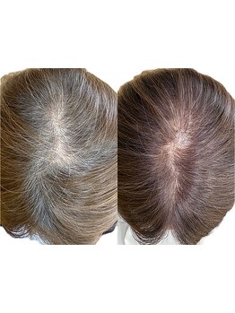 髪に優しい薬剤を使用し、ダメージレスで艶感のある仕上がりに♪気になる白髪もしっかり染まります！