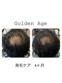 【 発　毛　ケ　ア ４ヶ月経過】Before＆After