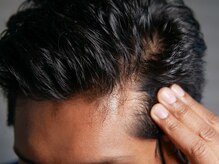 【白髪染め】自然な美しさを引き出す白髪染め。若々しさを保ちながら、艶やかで健康的な髪に仕上げます。