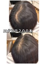 エミ(EMI)&nbsp;エスクテ