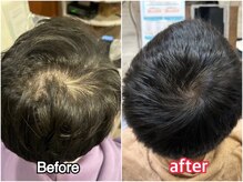 クレマチス(Clematis)の雰囲気(30代・男性のお客様♪頭皮が見えにくくなり喜ばれております)