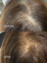 ココル 西新井(CoCoLu) 30代40代50代◎白髪染めリタッチカラーミディアムヘア西新井