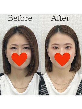 レトア(Letoa) ビフォーアフター