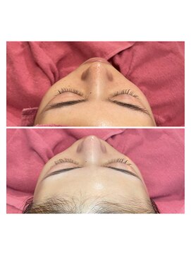 ヘアメイクエコー hair make echo レディースシェービング