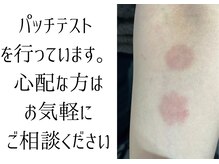 お肌が心配な方はパッチテストを行っています。