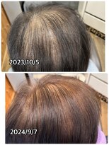 エミ(EMI)&nbsp;育毛促進