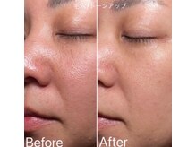 バーバーサンハチ(BARBER 38)の雰囲気（肌質改善で人に会うのも楽しくなります！【メンズカット/眉毛】 ）