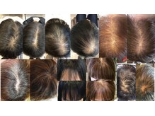 サーカス 銘苅店(circus)の雰囲気（最短4ヶ月で改善できる頭皮専門ケアも行っております。）