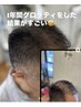 【抜け毛でお悩みの方へ】育毛促進スパ（ヒト幹細胞）