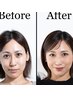 【SNS掲載OK限定割】Before→After 印象アップヘアセット＆メイク ￥13,500