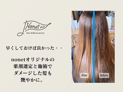 ノネット(Nonet plus)の写真