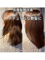 ロナロナ&nbsp;医療髪質改善トリートメント　カラーダメージ毛