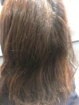 アンディヴァイド(UNDIVIDE) 営業ビフォーアフター スピエラ矯正+ACCトリートメント